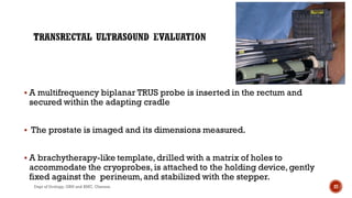  A multifrequency biplanar TRUS probe is inserted in the rectum and
secured within the adapting cradle
 The prostate is imaged and its dimensions measured.
 A brachytherapy-like template,drilled with a matrix of holes to
accommodate the cryoprobes,is attached to the holding device,gently
fixed against the perineum,and stabilized with the stepper.
27
Dept of Urology, GRH and KMC, Chennai.
 