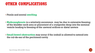 OTHER COMPLICATIONS
 Penile and scrotal swelling
 Hydronephrosis is a relatively uncommon may be due to extensive freezing
of the bladder neck area or placement of a cryoprobe deep into the seminal
vesicle leading to freezing of the ureteral orifices or distal ureters
 Small bowel obstruction may occur if the iceball is allowed to extend into
the cul-de-sac of the peritoneal cavity
41
Dept of Urology, GRH and KMC, Chennai.
 