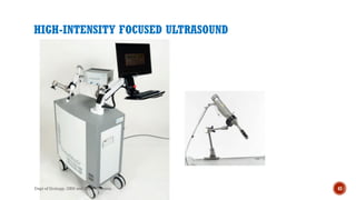 HIGH-INTENSITY FOCUSED ULTRASOUND
43
Dept of Urology, GRH and KMC, Chennai.
 