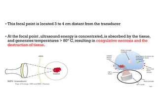  This focal point is located 3 to 4 cm distant from the transducer
 At the focal point ,ultrasound energy is concentrated,is absorbed by the tissue,
and generates temperatures > 80° C, resulting in coagulative necrosis and the
destruction of tissue.
46
Dept of Urology, GRH and KMC, Chennai.
 