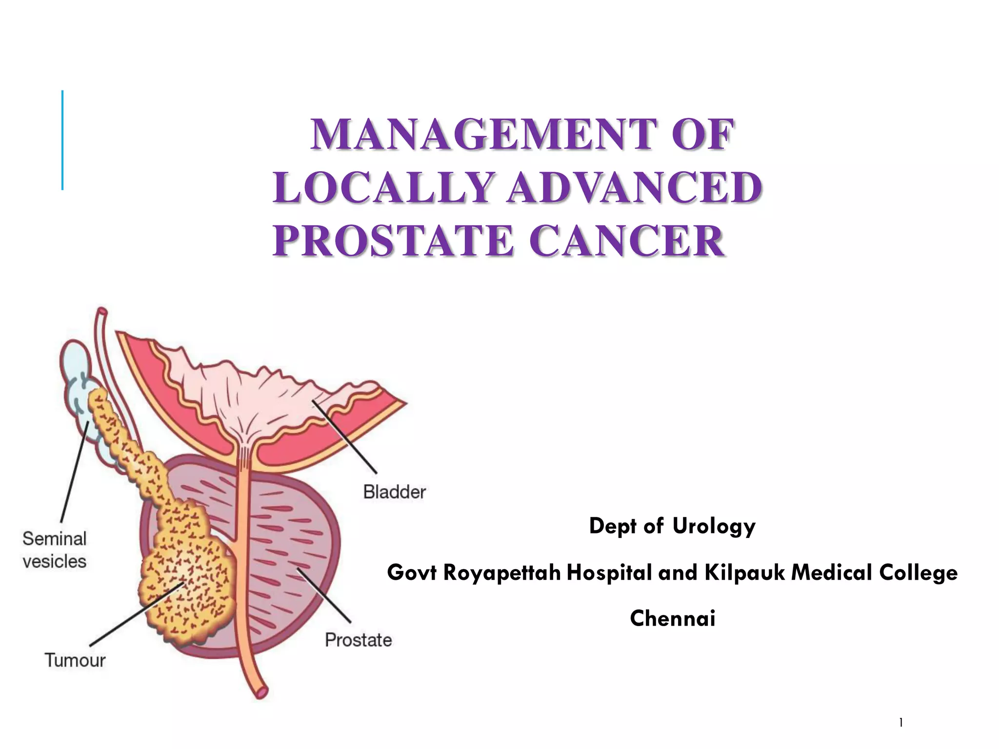Prostate carcinoma- locally advanced | PDF