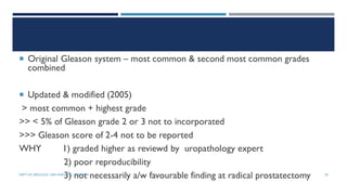 Modified Gleason Prostate carcinoma- pathology and staging | PDF