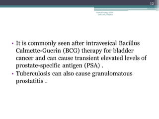 • It is commonly seen after intravesical Bacillus
Calmette-Guerin (BCG) therapy for bladder
cancer and can cause transient elevated levels of
prostate-specific antigen (PSA) .
• Tuberculosis can also cause granulomatous
prostatitis .
12
Dept of Urology, GRH
and KMC, Chennai.
 