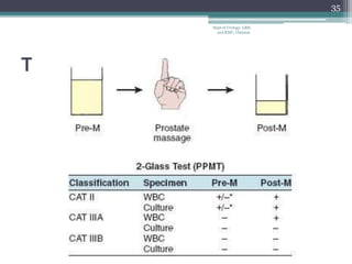 Two-glass Test
35
Dept of Urology, GRH
and KMC, Chennai.
 