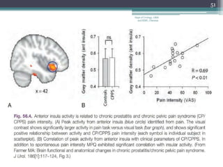 51
Dept of Urology, GRH
and KMC, Chennai.
 