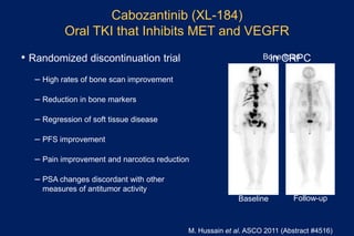 Cabozantinib (XL-184)
Oral TKI that Inhibits MET and VEGFR
• Randomized discontinuation trial in CRPC
– High rates of bone scan improvement
– Reduction in bone markers
– Regression of soft tissue disease
– PFS improvement
– Pain improvement and narcotics reduction
– PSA changes discordant with other
measures of antitumor activity
M. Hussain et al. ASCO 2011 (Abstract #4516)
Bone scan
Baseline Follow-up
 