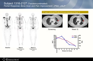 Subject 1316-2127 (Taxotere-pretreated)
Partial Response; Bone Scan and Pain Improvement; ↓PSA; ↓tALP
Screening Week 12
CT scan: confirmed PR with 41% tumor decrease at Week 12
-2 0 2 4 6 8 10 12 14
0
100
200
300
400
500
600
700
800
900
tALP
PSA
0
100
200
300
400
500
Screening
Weeks On Study
tALP
PSA
Baseline Week 6
Target lesions:
-33%
Week 12
Target lesions:
-41%
 