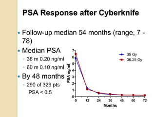 PSA Response after Cyberknife
 Follow-up median 54 months (range, 7 -
78)
 Median PSA
◦ 36 m 0.20 ng/ml
◦ 60 m 0.10 ng/ml
 By 48 months
◦ 290 of 329 pts
PSA < 0.5
0 12 24 36 48 60 72
0
1
2
3
4
5
6
7
35 Gy
36.25 Gy
Months
PSAng/ml
 