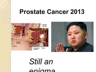 Prostate Cancer 2013
Still an
 