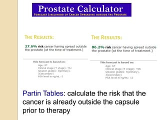 Partin Tables: calculate the risk that the
cancer is already outside the capsule
prior to therapy
 