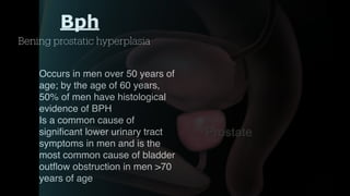 PROSTATE anatomy and bph management and treatment | PDF