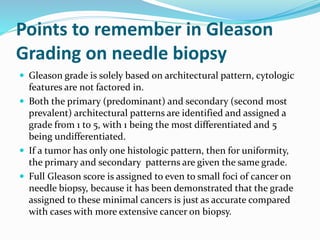 Points to remember in Gleason
Grading on needle biopsy
 Gleason grade is solely based on architectural pattern, cytologic
features are not factored in.
 Both the primary (predominant) and secondary (second most
prevalent) architectural patterns are identified and assigned a
grade from 1 to 5, with 1 being the most differentiated and 5
being undifferentiated.
 If a tumor has only one histologic pattern, then for uniformity,
the primary and secondary patterns are given the same grade.
 Full Gleason score is assigned to even to small foci of cancer on
needle biopsy, because it has been demonstrated that the grade
assigned to these minimal cancers is just as accurate compared
with cases with more extensive cancer on biopsy.
 