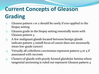 Current Concepts of Gleason
Grading
1. Gleason pattern 1 or 2 should be rarely if ever applied in the
biopsy setting
2. Gleason grade in the biopsy setting essentially starts with
Gleason pattern 3
3. A few malignant glands located between benign glands
indicate pattern 3 (small focus of cancer does not necessarily
mean low-grade cancer)
4. Virtually all cribriform carcinomas represent pattern 4 or 5 if
associated with necrosis
5. Clusters of glands with poorly formed glandular lumina where
tangential sectioning is ruled out represent Gleason pattern 4
 