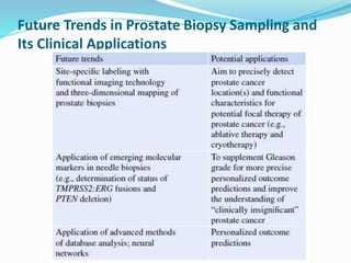 Future Trends in Prostate Biopsy Sampling and
Its Clinical Applications
 