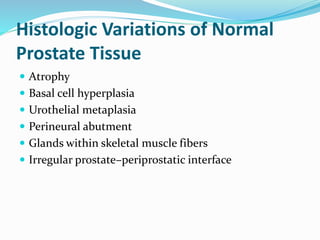 Histologic Variations of Normal
Prostate Tissue
 Atrophy
 Basal cell hyperplasia
 Urothelial metaplasia
 Perineural abutment
 Glands within skeletal muscle fibers
 Irregular prostate–periprostatic interface
 