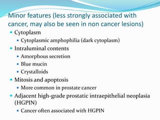 Minor features (less strongly associated with
cancer, may also be seen in non cancer lesions)
 Cytoplasm
 Cytoplasmic amphophilia (dark cytoplasm)
 Intraluminal contents
 Amorphous secretion
 Blue mucin
 Crystalloids
 Mitosis and apoptosis
 More common in prostate cancer
 Adjacent high-grade prostatic intraepithelial neoplasia
(HGPIN)
 Cancer often associated with HGPIN
 