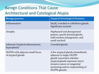 Benign Conditions That Cause
Architectural and Cytological Atypia
Benign process Atypical histological features
Inflammation Small, crowded or cribriform glands
Significant nucleoli
Atrophy Haphazard and disorganized
pattern, poorly formed glands,
mild nuclear enlargement, and
small nucleoli
Adenosis (atypical adenomatous
hyperplasia)
Crowded glands
HGPIN with adjacent small focus
of atypical glands
A few atypical glands immediately
adjacent to larger HGPIN
glands (uncertain whether
atypical glands represent micro
invasive cancer or tangential
sectioning and/or outpouching of
HGPIN glands)
 