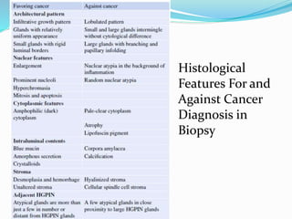 Histological
Features For and
Against Cancer
Diagnosis in
Biopsy
 