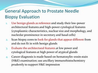 General Approach to Prostate Needle
Biopsy Evaluation
1. Use benign glands as reference and study their low-power
architectural features and high-power cytological features
(cytoplasmic characteristics, nuclear size and morphology, and
nucleolar prominence in secretory and basal cells)
2. Scan biopsy cores to look for glands that appear different from
and do not fit in with benign glands
3. Evaluate the architectural features at low power and
cytological features at high power of atypical glands
4. Cancer diagnosis is made based on hematoxylin–eosin stain
(H&E) examination; use ancillary immunohistochemistry
prudently to support H&E impression
 