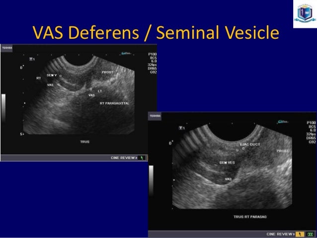 Prostate Biopsy--New Emerging Trends, Dr. Muhammad Bin Zulfiqar