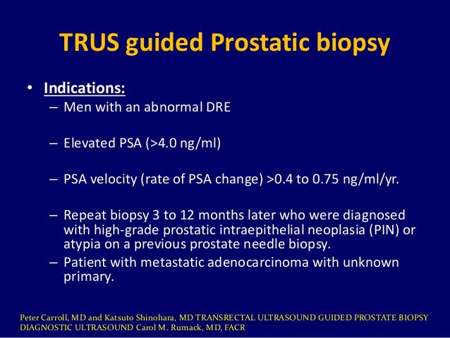 screening device f Dr. Biopsy Muhammad Bin Trends, New  Prostate Emerging