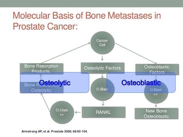 Bone Health In Prostate Cancer Patients