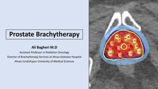 Prostate Brachytherapy
Ali Bagheri M.D
Assistant Professor in Radiation Oncology
Director of Brachytherapy Services at Ahvaz Golestan Hospital
Ahvaz Jundishapur University of Medical Sciences
 