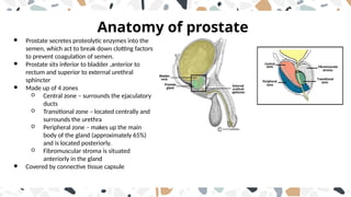 Proact Prostate prostate ca amnagement and diagnosis.pptx