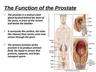 Prostate cancer