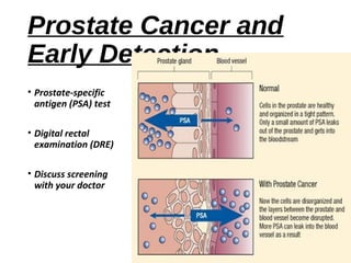 Prostate cancer