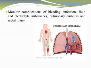 ⚫Monitor complications of bleeding, infection, fluid
and electrolyte imbalances, pulmonary embolus and
rectal injury.
 