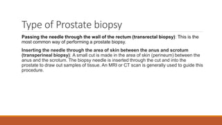 Type of Prostate biopsy
Passing the needle through the wall of the rectum (transrectal biopsy): This is the
most common way of performing a prostate biopsy.
Inserting the needle through the area of skin between the anus and scrotum
(transperineal biopsy): A small cut is made in the area of skin (perineum) between the
anus and the scrotum. The biopsy needle is inserted through the cut and into the
prostate to draw out samples of tissue. An MRI or CT scan is generally used to guide this
procedure.
 