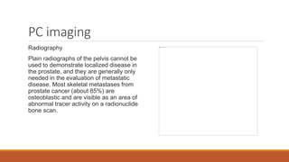 PC imaging
Radiography
Plain radiographs of the pelvis cannot be
used to demonstrate localized disease in
the prostate, and they are generally only
needed in the evaluation of metastatic
disease. Most skeletal metastases from
prostate cancer (about 85%) are
osteoblastic and are visible as an area of
abnormal tracer activity on a radionuclide
bone scan.
 