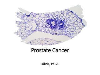 Prostate Cancer
Zikria, Ph.D.
 