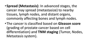 PROSTATE CANCER. a type of cancer that affects the prostate gland | PDF