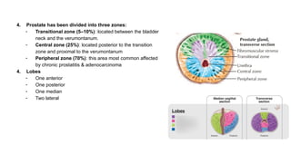Prostate Transaction Simple Example Prostate Cancer: A full presentation made simple | PPTX