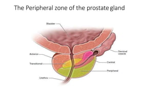 The Peripheral zone of the prostategland
 