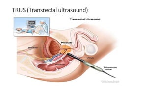 TRUS (Transrectal ultrasound)
 