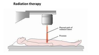 Radiation therapy
 