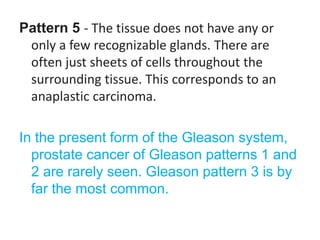 Prostate Pattern 5 prostate cancer by DR. MWEBAZA VICTOR.pptx