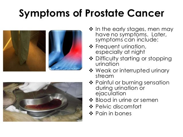 What are the signs for prostate cancer
