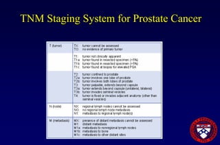 Prostate Cancer Overview