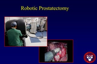 Prostate Cancer Overview