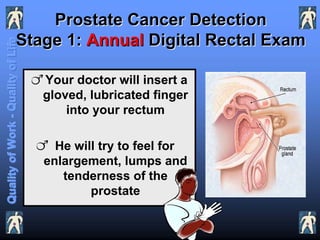 Prostate Cancer