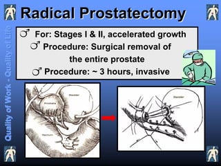 Prostate Cancer