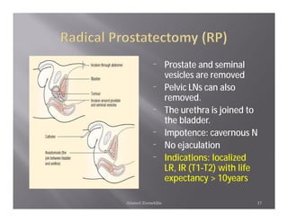 ¨      Prostate and seminal
                  vesicles are removed
           ¨      Pelvic LNs can also
                  removed.
           ¨      The urethra is joined to
                  the bladder.
           ¨      Impotence: cavernous N
           ¨      No ejaculation
           ¨      Indications: localized
                  LR, IR (T1-T2) with life
                  expectancy > 10years

Ahmed Zeeneldin                          17
 