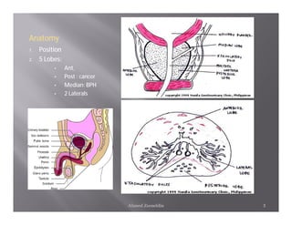 Anatomy
1.   Position
2.   5 Lobes:
          •     Ant,
          •     Post : cancer
          •     Median: BPH
          •     2 Laterals




                                Ahmed Zeeneldin   3
 
