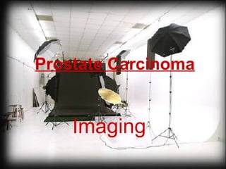 Prostate Carcinoma
Imaging
 