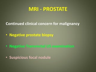 MRI - PROSTATE
Continued clinical concern for malignancy
• Negative prostate biopsy
• Negative Transrectal US examination
• Suspicious focal nodule
 
