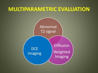 MULTIPARAMETRIC EVALUATION
Abnormal
T2 signal
Diffusion
Weighted
Imaging
DCE
imaging
 